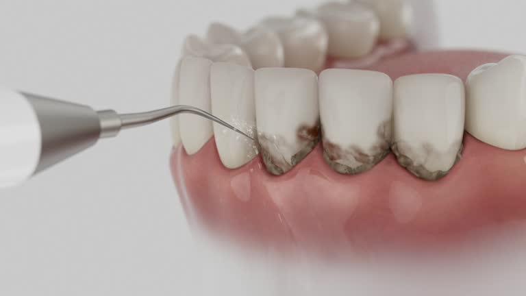 Trusted Teeth Cleaning And Checkup service in Sulphur, OK - Dentist Open Now